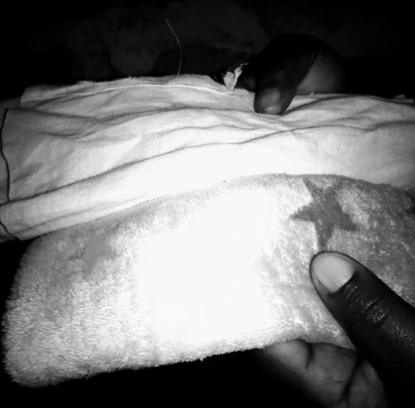 The Survival of a disabled slum girl child in menstruation hygiene